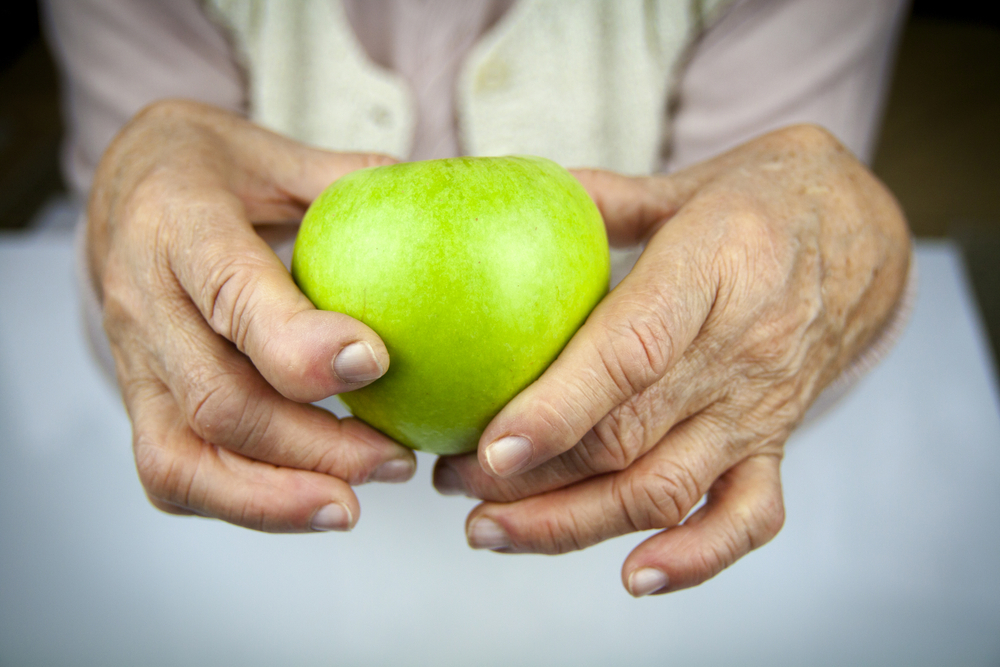 Rheumatoid,Arthritis,Hands,And,Fruits.,Apple,In,Hand
