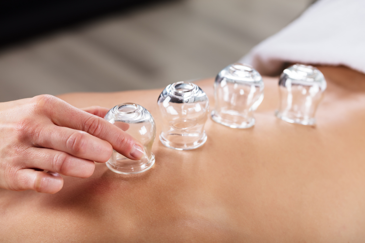 Therapist,Placing,Transparent,Glass,Cups,On,Person's,Back,In,Spa