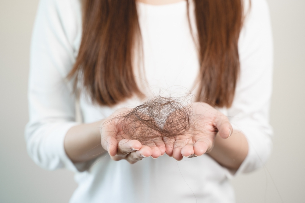Hair,Loss,Problem,,Asian,Woman,Look,At,Hair,Fall,In