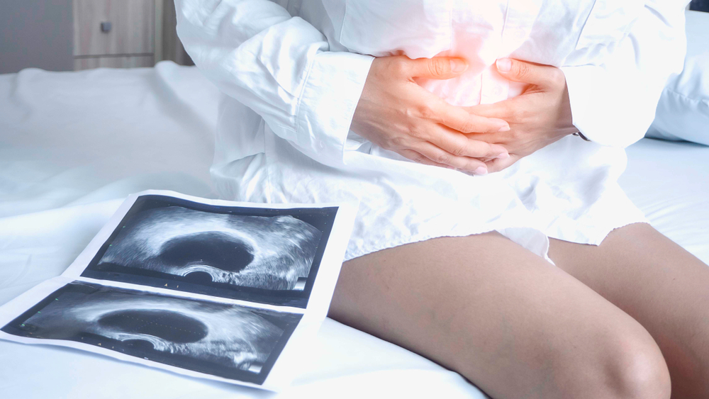 Uterus,,Ovaries,,Ovarian,Cysts,And,Abnormalities,In,Cells,,Close,To