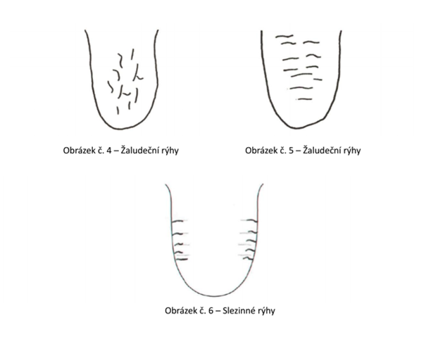 Obrzek 4,5 a 6