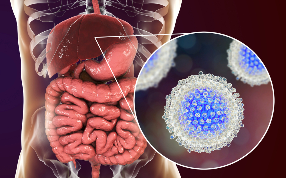 Hepatitis,C,Virus,Infection,Medical,Concept,,3d,Illustration