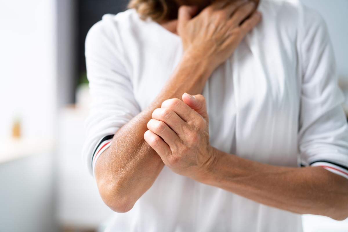 Woman,Scratching,Itching,Body,Skin,With,Allergy