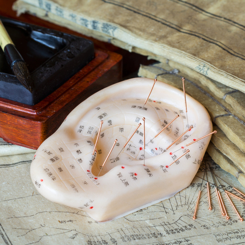 Akupunkturn body ucha, kter se vyplat znt