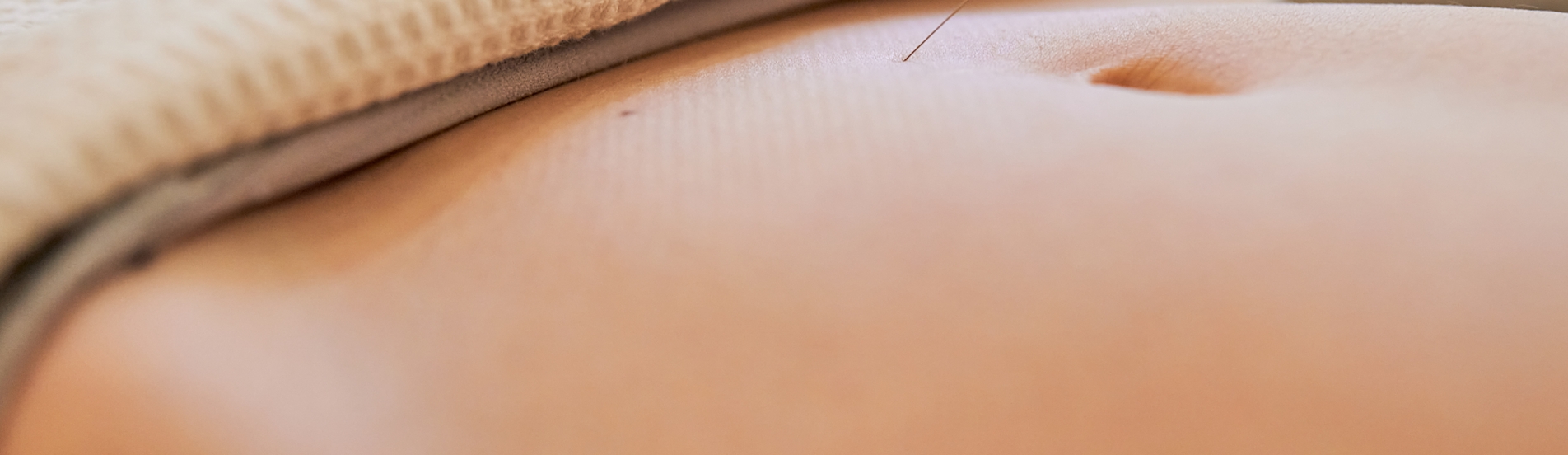 Akupunktura jako jedna z metod pomoci pi ensk neplodnosti 