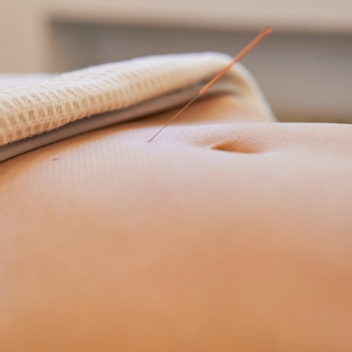 Akupunktura jako jedna z metod pomoci při ženské neplodnosti 