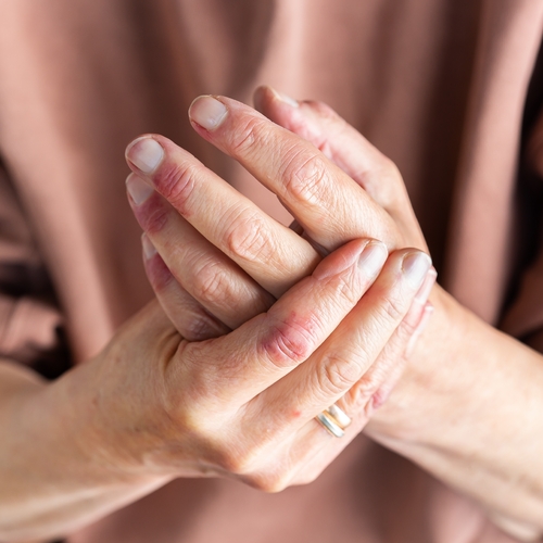 Ekz�my nereaguj�c� na l��bu, jak se dostat k p���in�